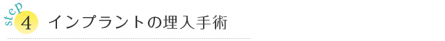 STEP④ インプラントの埋入手術 STEP④ インプラントの埋入手術